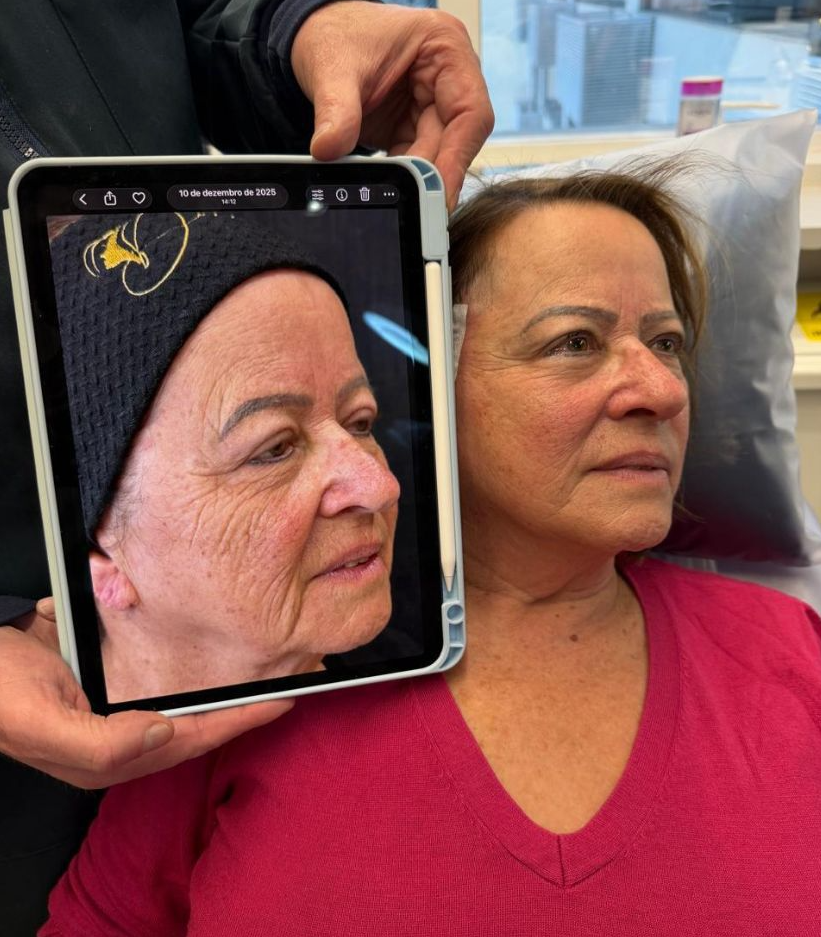Harmonização Facial