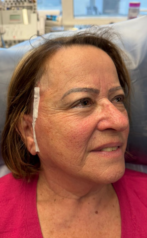 Paciente 4 - Harmonização Facial — depois
